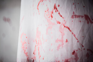 Bloodstains on a white mattress fabric, illustrating a cleaning challenge addressed in the blog.